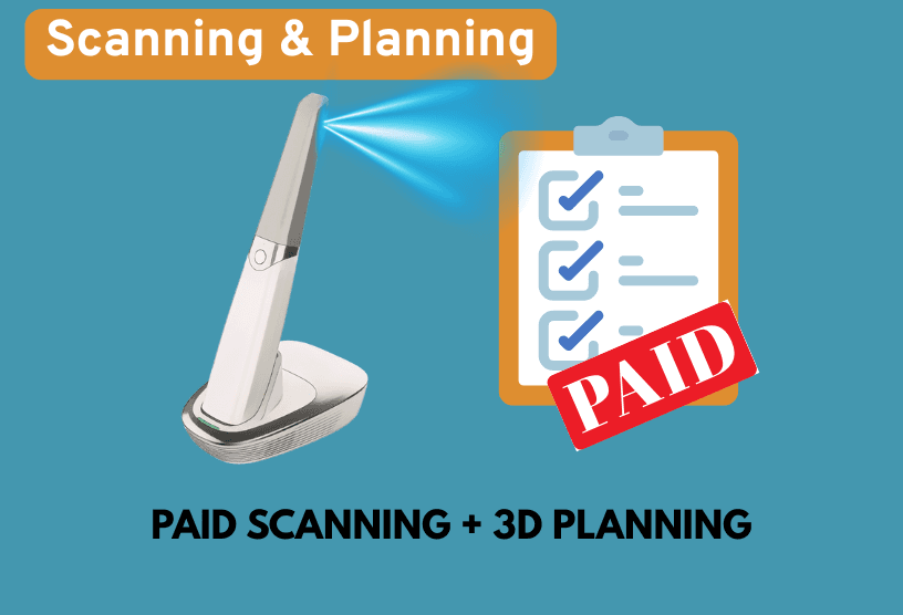 Aligner360 Clear Aligners Result 6